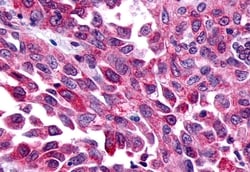 FZD8 Polyclonal Antibody:Antibodies, Polyclonal