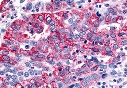 Invitrogen GABBR1 Polyclonal Antibody 50 &mu;g; Unconjugated:Antibodies,