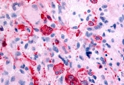 Invitrogen GABBR1 Polyclonal Antibody 50 &mu;g; Unconjugated:Antibodies,