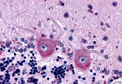Invitrogen GABBR1 Polyclonal Antibody 50 &mu;g; Unconjugated:Antibodies,