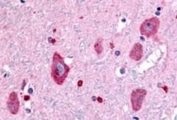 Invitrogen GABBR1 Polyclonal Antibody 50 &mu;g; Unconjugated:Antibodies,