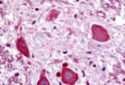 Invitrogen GABBR1 Polyclonal Antibody 50 &mu;g; Unconjugated:Antibodies,