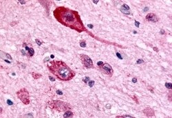 Invitrogen GABBR1 Polyclonal Antibody 50 μg; Unconjugated:Antibodies,
