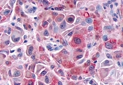 Invitrogen GALR1 Polyclonal Antibody 50 μg; Unconjugated:Antibodies,