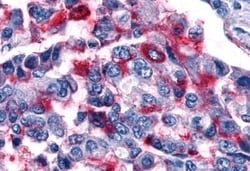 Invitrogen GALR1 Polyclonal Antibody 50 μg; Unconjugated:Antibodies,