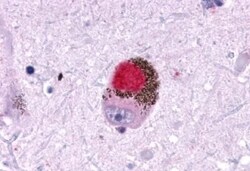 Invitrogen GALR1 Polyclonal Antibody 50 μg; Unconjugated:Antibodies,