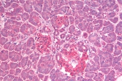 Invitrogen GLP1R Polyclonal Antibody 50 μg; Unconjugated:Antibodies,