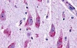 Invitrogen GLP2R Polyclonal Antibody 50 μg; Unconjugated:Antibodies,