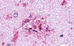 Invitrogen GLP2R Polyclonal Antibody 50 μg; Unconjugated:Antibodies,