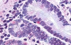 Invitrogen GLP2R Polyclonal Antibody 50 μg; Unconjugated:Antibodies,