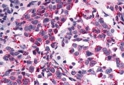 Invitrogen GPR1 Polyclonal Antibody 50 &mu;g; Unconjugated:Antibodies,