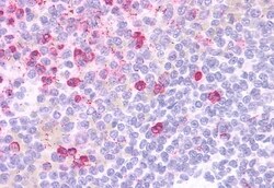 Invitrogen GPR109B Polyclonal Antibody 50 &mu;g | Buy Online | Invitrogen&trade; | Fisher Scientific