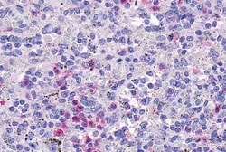 Invitrogen GPR109B Polyclonal Antibody 50 &mu;g | Buy Online | Invitrogen&trade; | Fisher Scientific