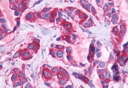 Invitrogen GPR110 Polyclonal Antibody 50 &mu;g; Unconjugated:Antibodies,