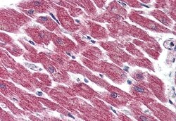 Invitrogen GPR116 Polyclonal Antibody 50 &mu;g; Unconjugated:Antibodies,
