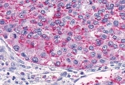 Invitrogen TEM5 Polyclonal Antibody 50 &mu;g; Unconjugated:Antibodies,