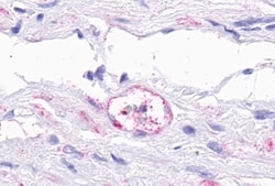 Invitrogen TEM5 Polyclonal Antibody 50 &mu;g; Unconjugated:Antibodies,