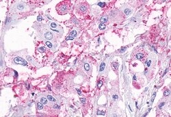 Invitrogen TEM5 Polyclonal Antibody 50 &mu;g; Unconjugated:Antibodies,
