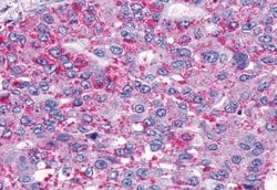 Invitrogen TEM5 Polyclonal Antibody 50 &mu;g; Unconjugated:Antibodies,