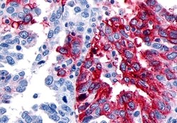 Invitrogen GPR133 Polyclonal Antibody 50 μg; Unconjugated:Antibodies,