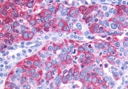 Invitrogen GPR143 Polyclonal Antibody 50 &mu;g; Unconjugated:Antibodies,