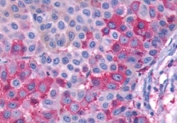 Invitrogen GPR143 Polyclonal Antibody 50 &mu;g; Unconjugated:Antibodies,