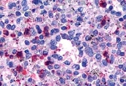 Invitrogen GPR146 Polyclonal Antibody 50 &mu;g; Unconjugated:Antibodies,