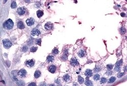 Invitrogen GPR149 Polyclonal Antibody 50 &mu;g | Buy Online | Invitrogen&trade; | Fisher Scientific