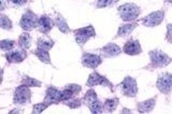 Invitrogen GPR17 Polyclonal Antibody 50 &mu;g | Buy Online | Invitrogen&trade; | Fisher Scientific