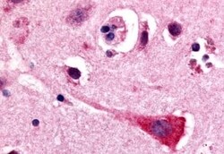 Invitrogen GPR17 Polyclonal Antibody 50 &mu;g | Buy Online | Invitrogen&trade; | Fisher Scientific