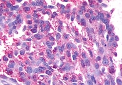 Invitrogen GPR17 Polyclonal Antibody 50 &mu;g; Unconjugated:Antibodies,