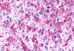 Invitrogen GPR17 Polyclonal Antibody 50 &mu;g; Unconjugated:Antibodies,