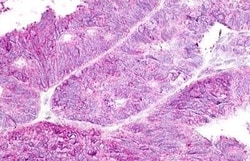 Invitrogen GPR19 Polyclonal Antibody 50 &mu;g | Buy Online | Invitrogen&trade; | Fisher Scientific