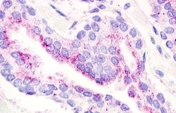 Invitrogen GPR21 Polyclonal Antibody 50 μg; Unconjugated:Antibodies,