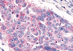 Invitrogen GPR26 Polyclonal Antibody 50 &mu;g | Buy Online | Invitrogen&trade; | Fisher Scientific