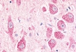 Invitrogen GPR26 Polyclonal Antibody 50 &mu;g | Buy Online | Invitrogen&trade; | Fisher Scientific