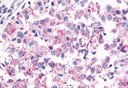 Invitrogen GPR26 Polyclonal Antibody 50 &mu;g | Buy Online | Invitrogen&trade; | Fisher Scientific