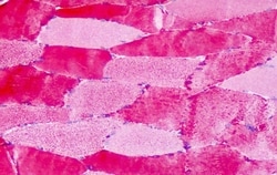 Invitrogen GPR30 Polyclonal Antibody 50 &mu;g; Unconjugated:Antibodies,