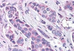 Invitrogen GPR30 Polyclonal Antibody 50 &mu;g | Buy Online | Invitrogen&trade; | Fisher Scientific