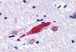 Invitrogen GPR30 Polyclonal Antibody 50 &mu;g | Buy Online | Invitrogen&trade; | Fisher Scientific