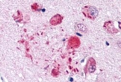 Invitrogen GPR30 Polyclonal Antibody 50 &mu;g | Buy Online | Invitrogen&trade; | Fisher Scientific