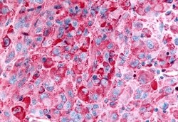 Invitrogen GPR35 Polyclonal Antibody 50 &mu;g; Unconjugated:Antibodies,