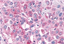 Invitrogen GPR4 Polyclonal Antibody 50 &mu;g; Unconjugated:Antibodies,