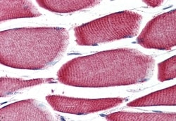 Invitrogen GPR43 Polyclonal Antibody 50 &mu;g | Buy Online | Invitrogen&trade; | Fisher Scientific