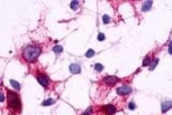 Invitrogen CRTH2 Polyclonal Antibody 50 &mu;g; Unconjugated:Antibodies,