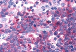 Invitrogen CRTH2 Polyclonal Antibody 50 &mu;g; Unconjugated:Antibodies,