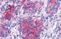 Invitrogen CRTH2 Polyclonal Antibody 50 &mu;g; Unconjugated:Antibodies,