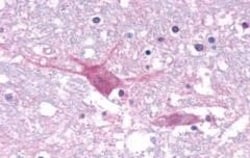 Invitrogen CRTH2 Polyclonal Antibody 50 &mu;g; Unconjugated:Antibodies,