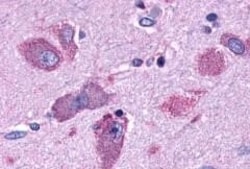 Invitrogen CRTH2 Polyclonal Antibody 50 &mu;g; Unconjugated:Antibodies,