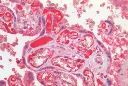 Invitrogen LGR5 Polyclonal Antibody 50 &mu;g; Unconjugated:Antibodies,